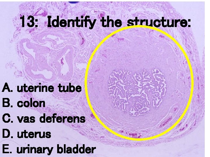 13: Identify the structure: A. uterine tube B. colon C. vas deferens D. uterus 13: Identify the structure: A. uterine tube B. colon C. vas deferens D. uterus