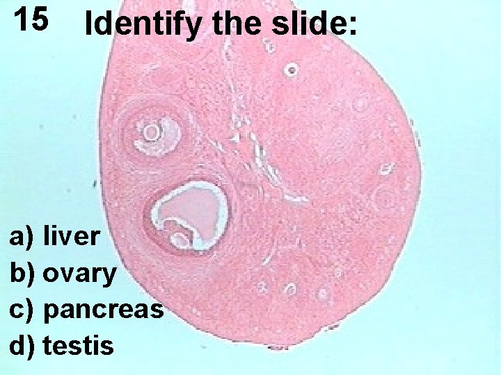 15 Identify the slide: a) liver b) ovary c) pancreas d) testis 15 Identify the slide: a) liver b) ovary c) pancreas d) testis