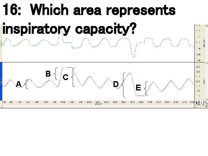 16: Which area represents inspiratory capacity? B A C D E 16: Which area represents inspiratory capacity? B A C D E