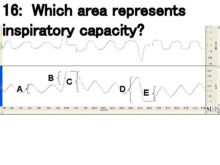 16: Which area represents inspiratory capacity? B A C D E 