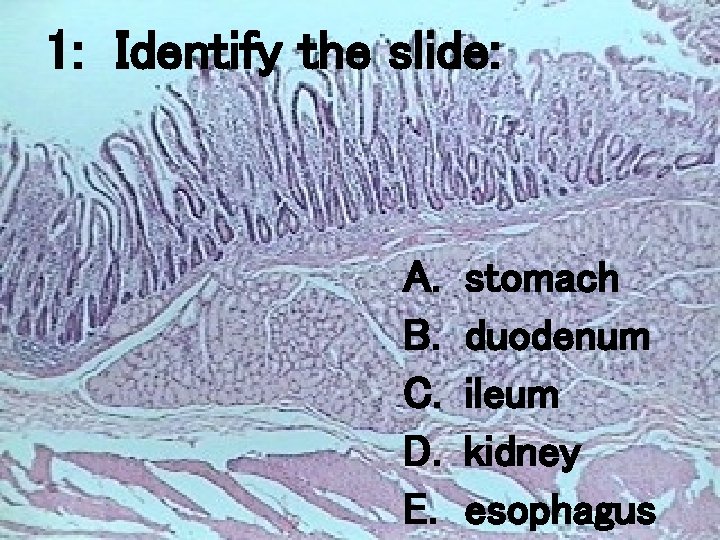 1: Identify the slide: A. B. C. D. E. stomach duodenum ileum kidney esophagus 1: Identify the slide: A. B. C. D. E. stomach duodenum ileum kidney esophagus