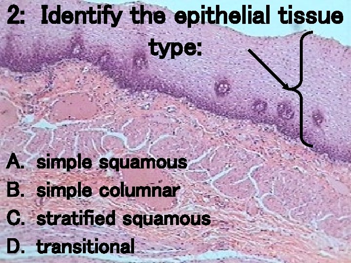 2: Identify the epithelial tissue type: A. B. C. D. simple squamous simple columnar 2: Identify the epithelial tissue type: A. B. C. D. simple squamous simple columnar