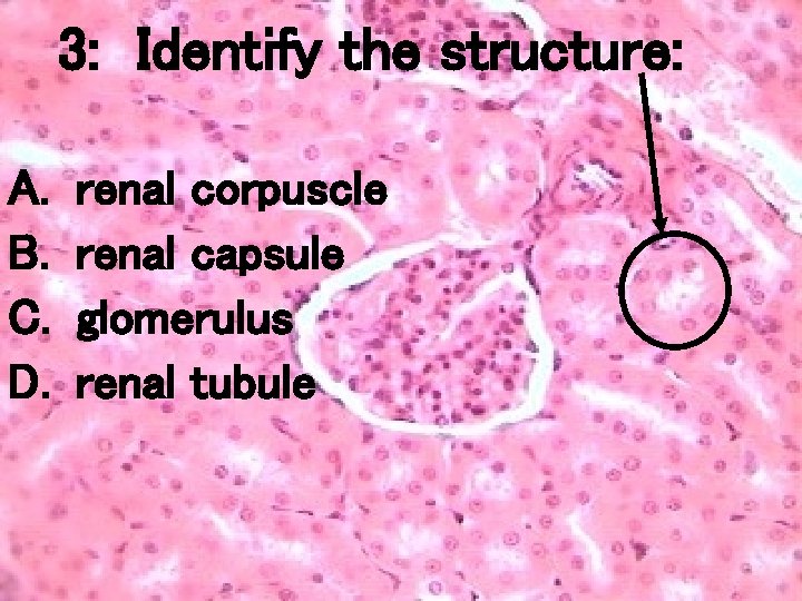 3: Identify the structure: A. B. C. D. renal corpuscle renal capsule glomerulus renal