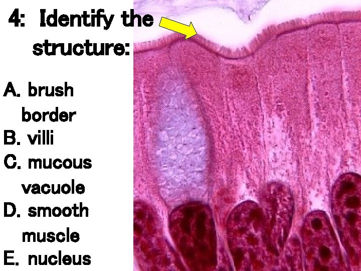 4: Identify the structure: A. brush border B. villi C. mucous vacuole D. smooth 4: Identify the structure: A. brush border B. villi C. mucous vacuole D. smooth