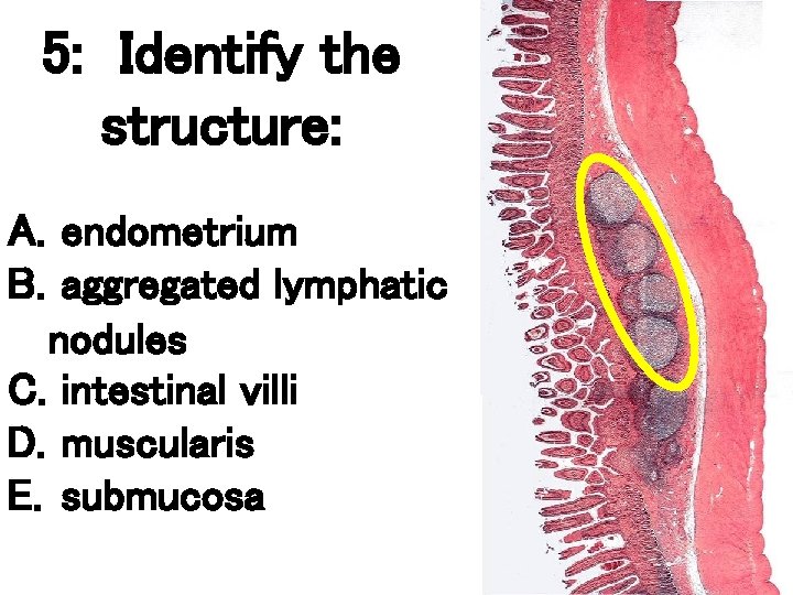 5: Identify the structure: A. endometrium B. aggregated lymphatic nodules C. intestinal villi D. 5: Identify the structure: A. endometrium B. aggregated lymphatic nodules C. intestinal villi D.
