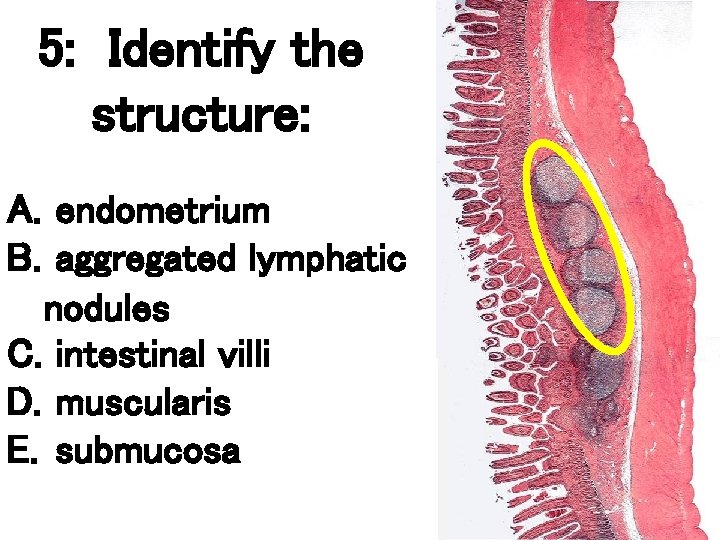 5: Identify the structure: A. endometrium B. aggregated lymphatic nodules C. intestinal villi D.