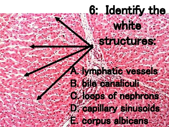 6: Identify the white structures: A. lymphatic vessels B. bile canaliculi C. loops of 6: Identify the white structures: A. lymphatic vessels B. bile canaliculi C. loops of