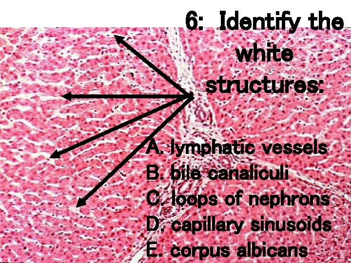 6: Identify the white structures: A. lymphatic vessels B. bile canaliculi C. loops of