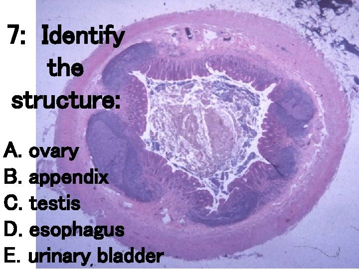 7: Identify the structure: A. ovary B. appendix C. testis D. esophagus E. urinary 7: Identify the structure: A. ovary B. appendix C. testis D. esophagus E. urinary