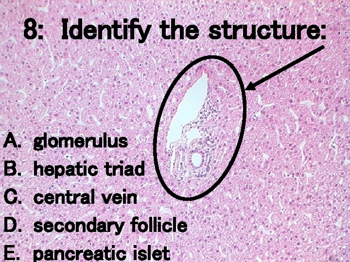 8: Identify the structure: A. B. C. D. E. glomerulus hepatic triad central vein 8: Identify the structure: A. B. C. D. E. glomerulus hepatic triad central vein