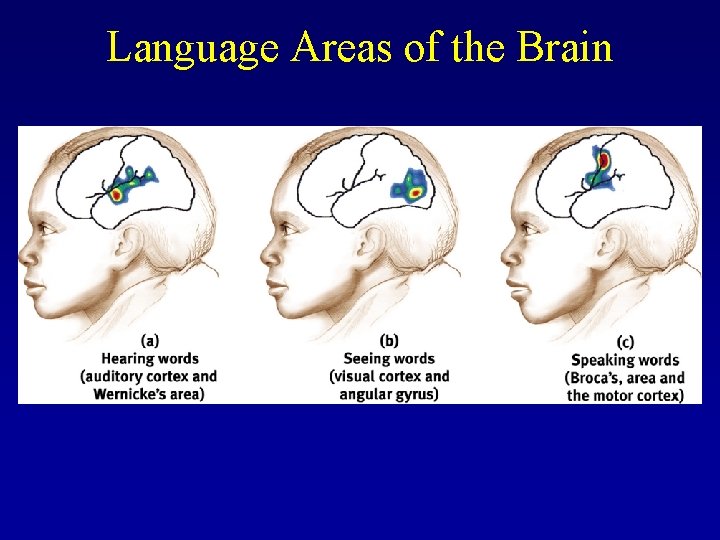 Language Areas of the Brain 