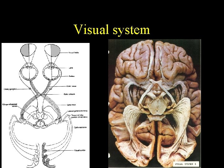 Visual system 