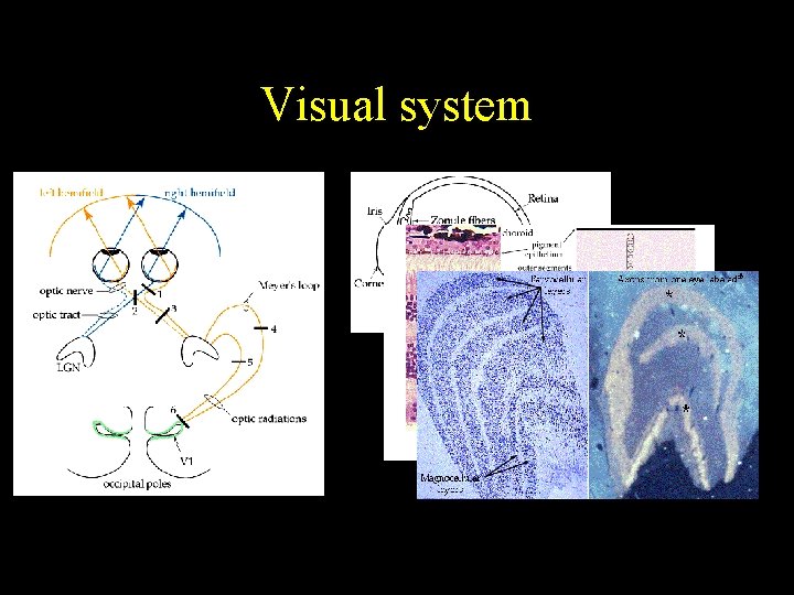 Visual system 
