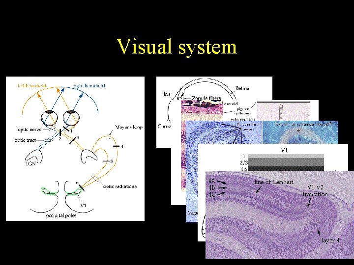 Visual system 