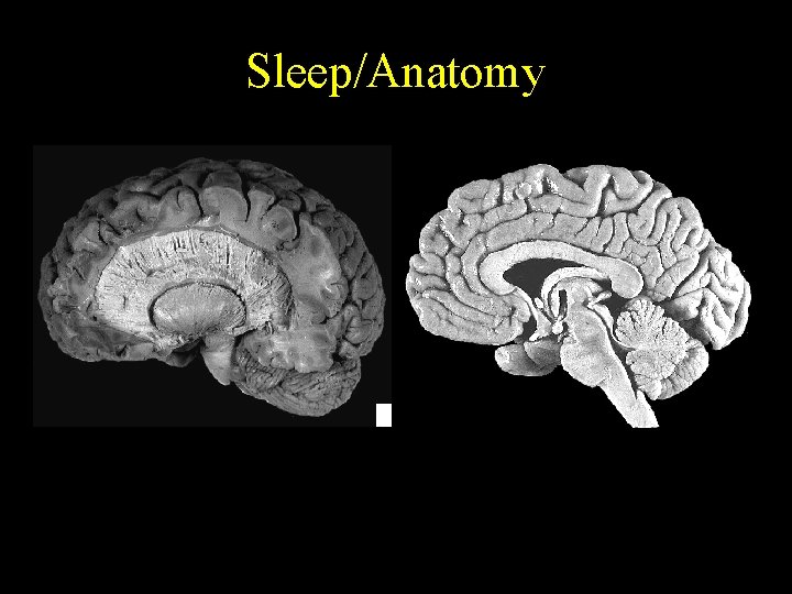 Sleep/Anatomy 