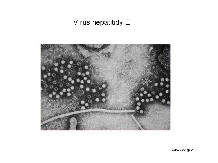 Virus hepatitidy E www. cdc. gov 