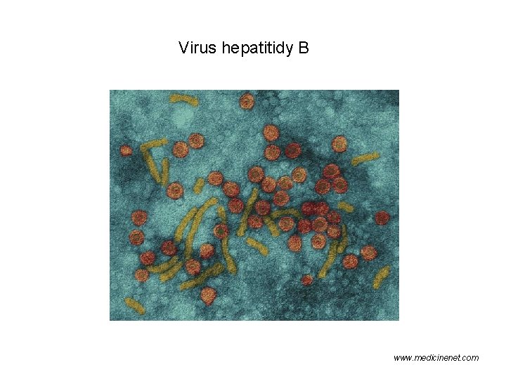 Virus hepatitidy B www. medicinenet. com 