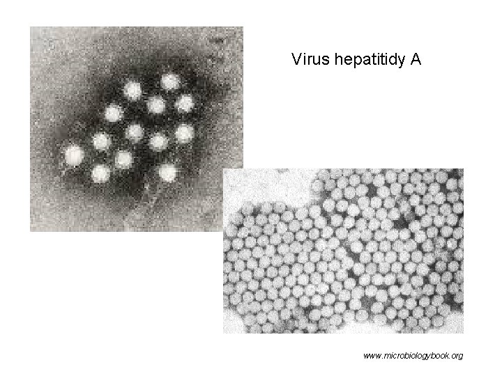 Virus hepatitidy A www. microbiologybook. org 