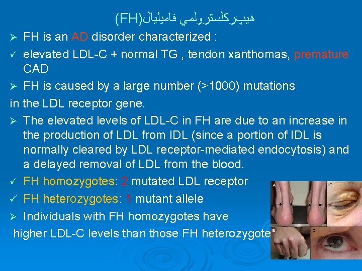 (FH) ﻫﻴپﺮﻛﻠﺴﺘﺮﻭﻟﻤﻲ ﻓﺎﻣﻴﻠﻴﺎﻝ FH is an AD disorder characterized : ü elevated LDL-C +