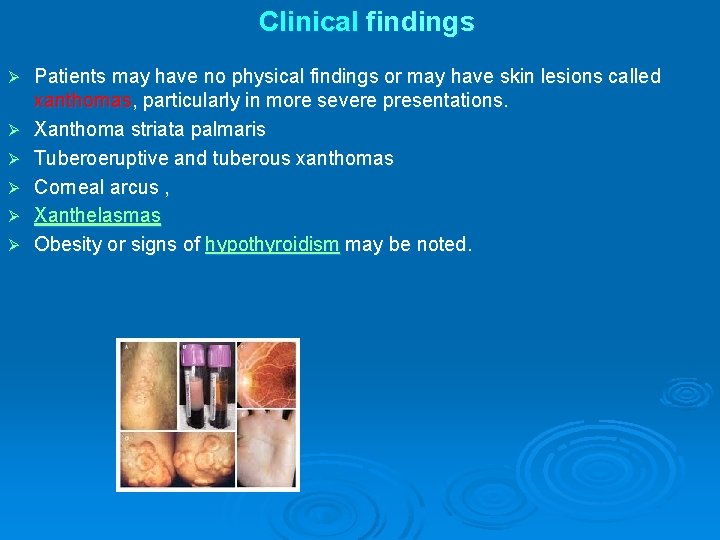 Clinical findings Ø Ø Ø Patients may have no physical findings or may have