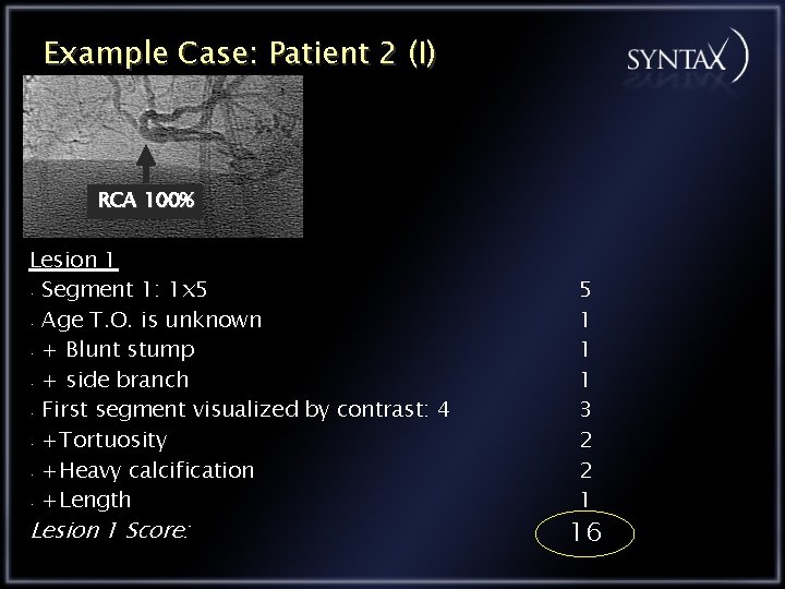 Example Case: Patient 2 (I) RCA 100% Lesion 1 • Segment 1: 1 x