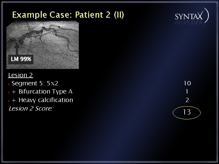 Example Case: Patient 2 (II) LM 99% Lesion 2 Segment 5: 5 x 2
