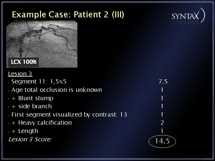 Example Case: Patient 2 (III) LCX 100% Lesion 3 Segment 11: 1, 5 x