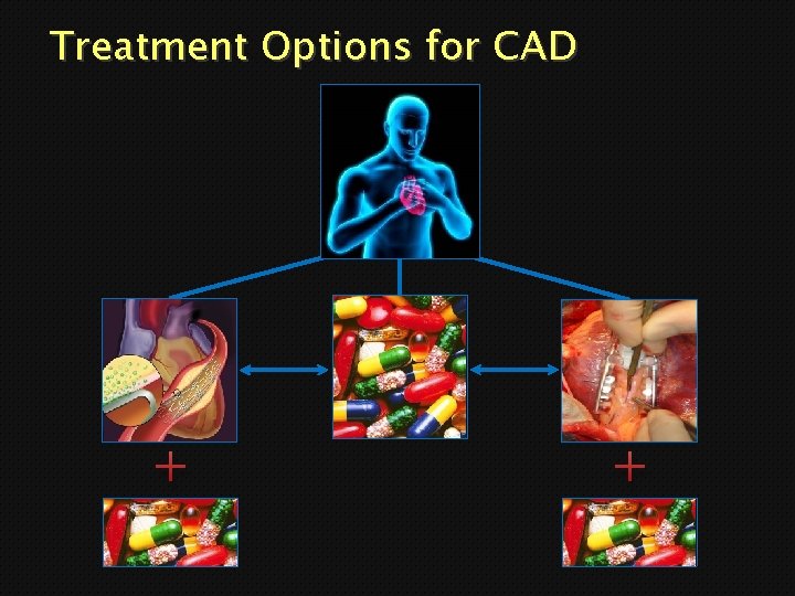 Treatment Options for CAD + + 