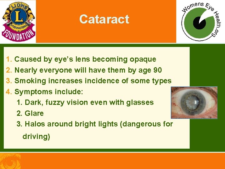 Cataract 1. Caused by eye’s lens becoming opaque 2. Nearly everyone will have them