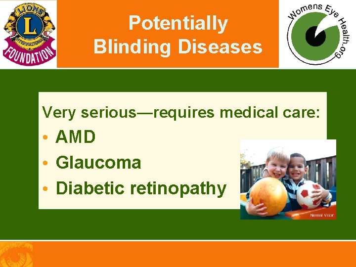 Potentially Blinding Diseases Very serious—requires medical care: • AMD • Glaucoma • Diabetic retinopathy