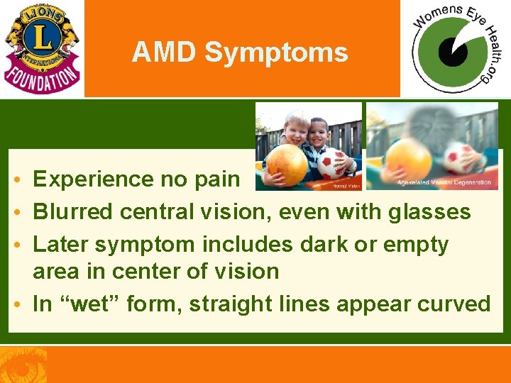 AMD Symptoms • Experience no pain • Blurred central vision, even with glasses •