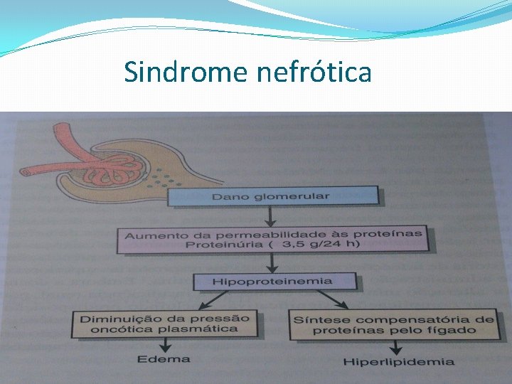 TRABAj O DE FISIOPATOLOGIA SINDROME NEFROTICA Y NEFRITICA