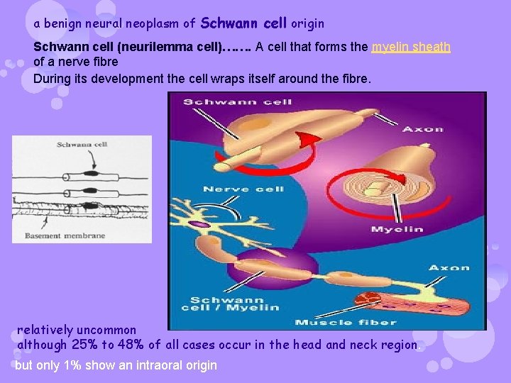 a benign neural neoplasm of Schwann cell origin Schwann cell (neurilemma cell)……. A cell