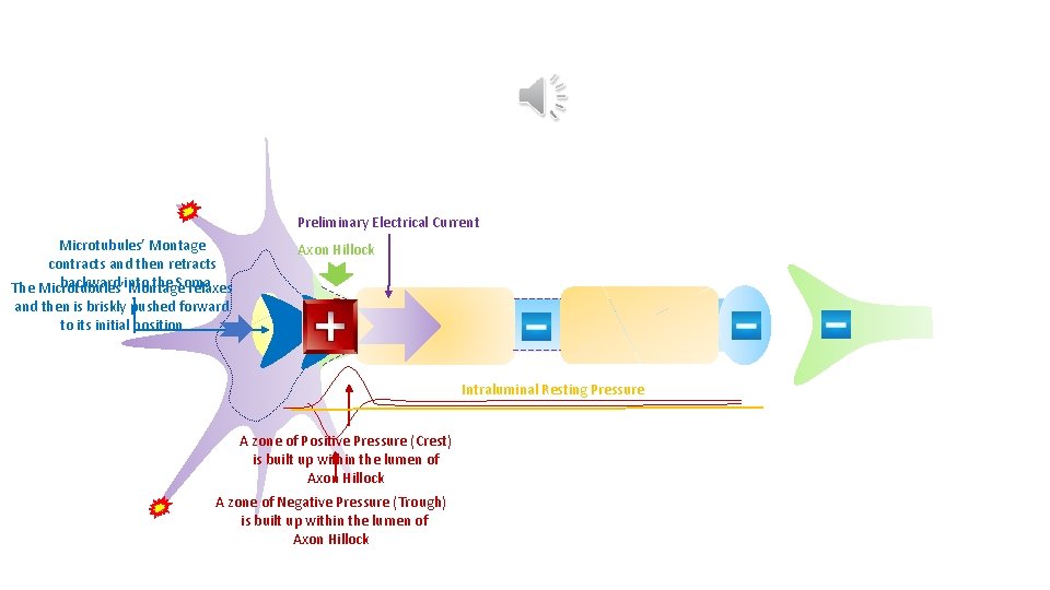 Preliminary Electrical Current Microtubules’ Montage contracts and then retracts backward into the Soma The