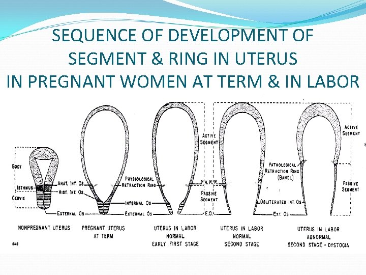 SEQUENCE OF DEVELOPMENT OF SEGMENT & RING IN UTERUS IN PREGNANT WOMEN AT TERM