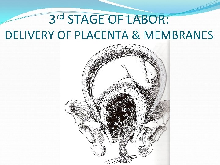 rd 3 STAGE OF LABOR: DELIVERY OF PLACENTA & MEMBRANES 