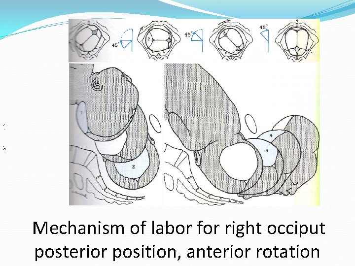 , . , 0 Mechanism of labor for right occiput posterior position, anterior rotation