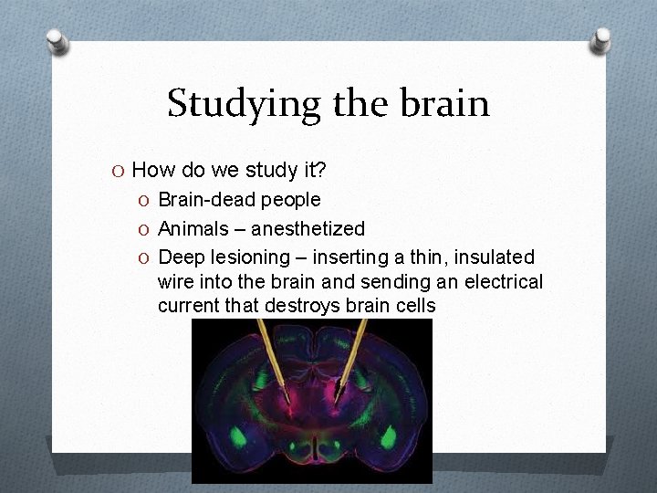 Studying the brain O How do we study it? O Brain-dead people O Animals
