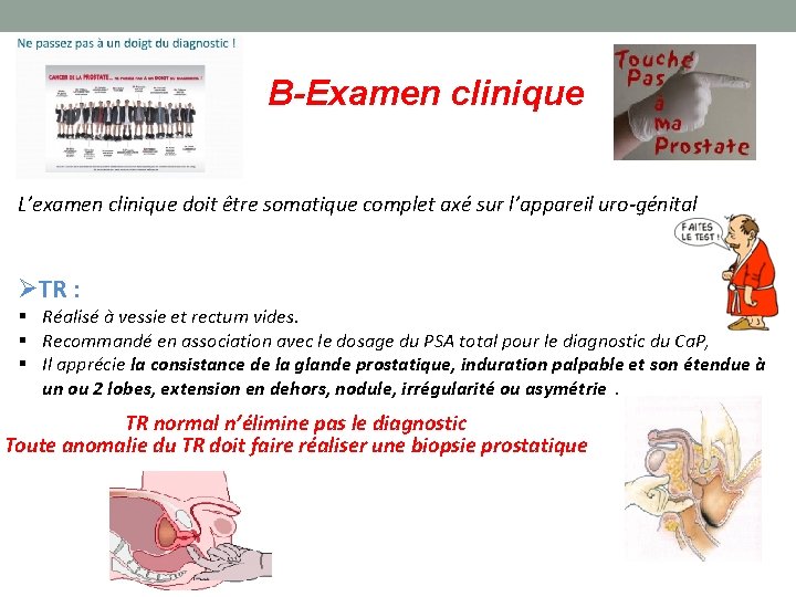 B-Examen clinique L’examen clinique doit être somatique complet axé sur l’appareil uro-génital TR :