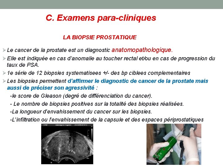 C. Examens para-cliniques LA BIOPSIE PROSTATIQUE Le cancer de la prostate est un diagnostic