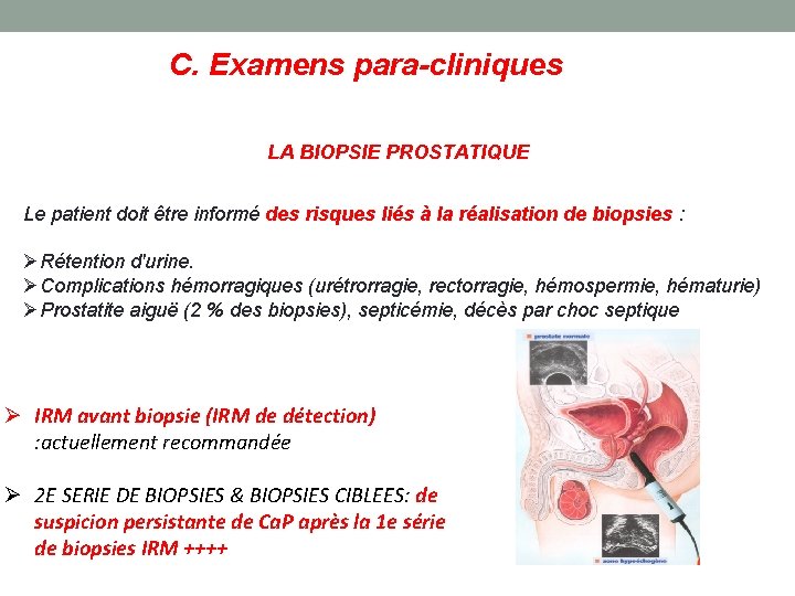 C. Examens para-cliniques LA BIOPSIE PROSTATIQUE Le patient doit être informé des risques liés