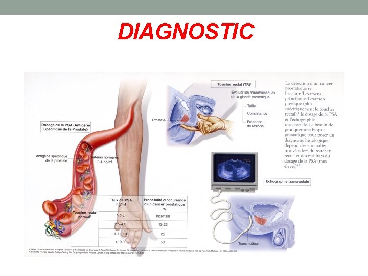 DIAGNOSTIC 