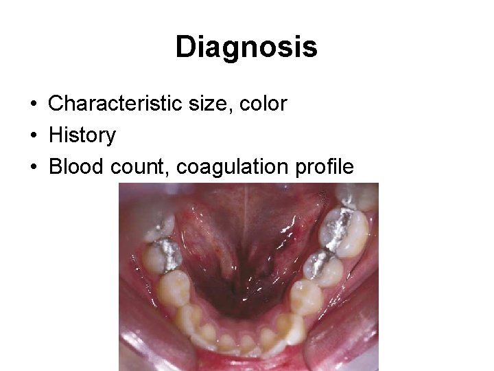 Diagnosis • Characteristic size, color • History • Blood count, coagulation profile 