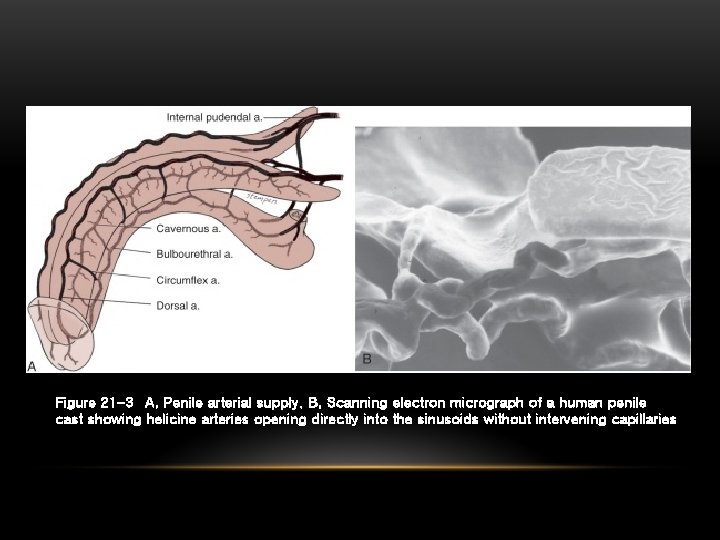 Figure 21 -3 A, Penile arterial supply. B, Scanning electron micrograph of a human