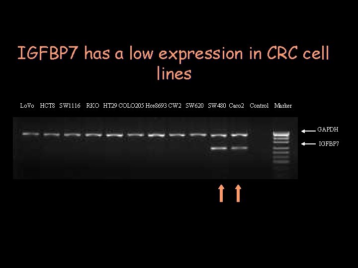 IGFBP 7 has a low expression in CRC cell lines Lo. Vo HCT 8