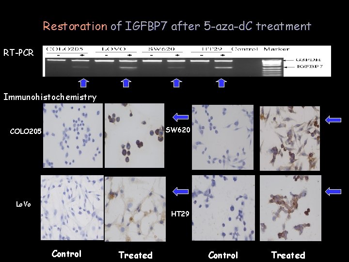 Restoration of IGFBP 7 after 5 -aza-d. C treatment RT-PCR Immunohistochemistry SW 620 COLO