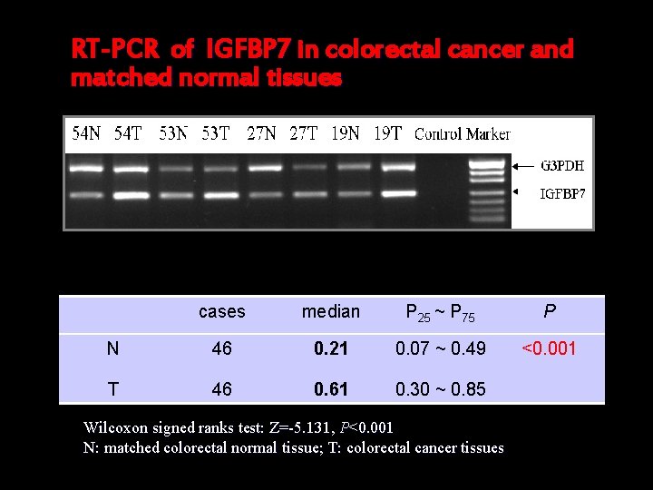 RT-PCR of IGFBP 7 in colorectal cancer and matched normal tissues cases median P
