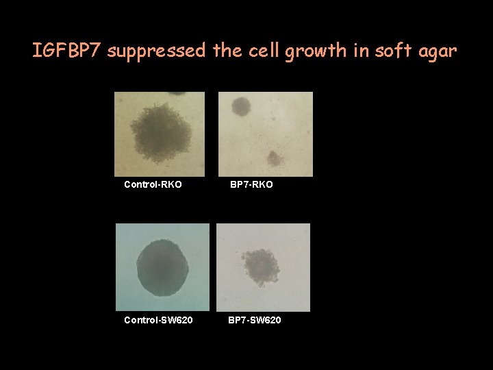 IGFBP 7 suppressed the cell growth in soft agar Control-RKO BP 7 -RKO Control-SW