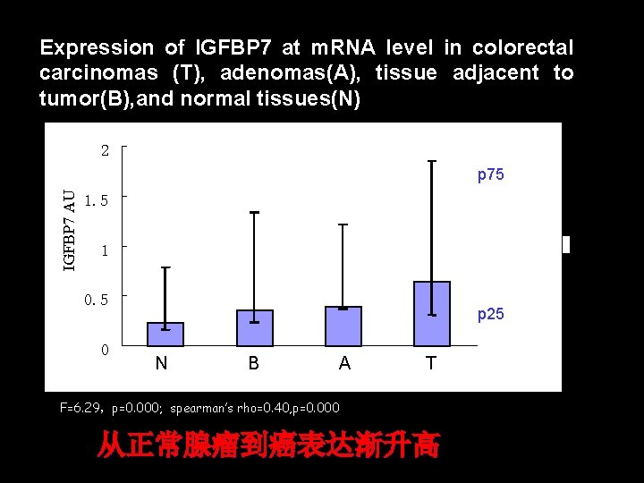 Expression of IGFBP 7 at m. RNA level in colorectal carcinomas (T), adenomas(A), tissue
