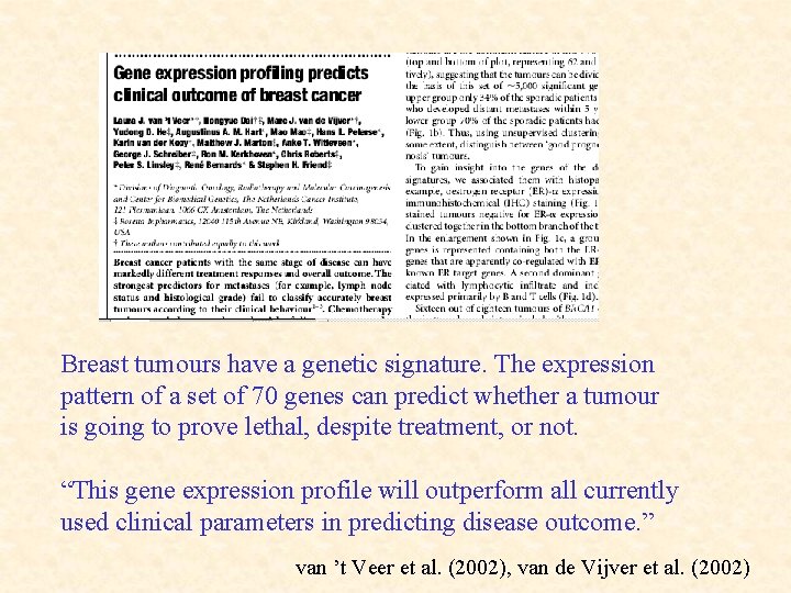 Breast tumours have a genetic signature. The expression pattern of a set of 70